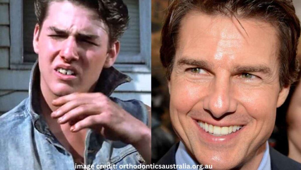 Tom Cruise